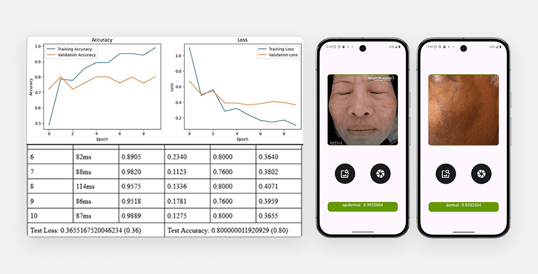 Melasma Diagnoser project screenshot